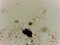 Echiniscoides sigismundi image