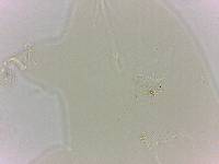 Echiniscoides sigismundi image