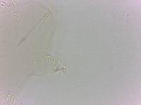 Echiniscoides sigismundi image