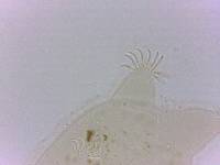 Echiniscoides sigismundi image