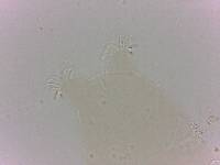 Echiniscoides sigismundi image