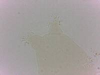 Echiniscoides sigismundi image
