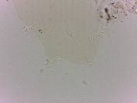 Echiniscoides sigismundi image