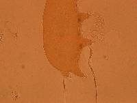 Echiniscoides sigismundi image