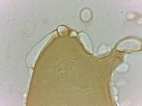 Echiniscoides sigismundi image