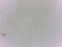 Echiniscoides sigismundi image