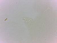 Echiniscoides sigismundi image