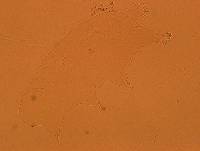 Echiniscoides sigismundi image