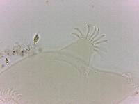 Echiniscoides sigismundi image