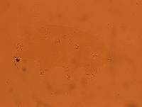 Echiniscoides sigismundi image