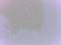 Echiniscoides sigismundi image
