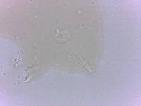Echiniscoides sigismundi image