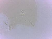 Echiniscoides sigismundi image