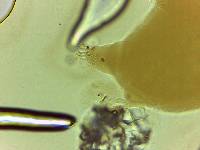 Echiniscoides sigismundi image