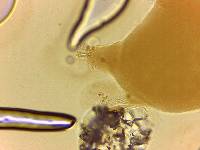 Echiniscoides sigismundi image