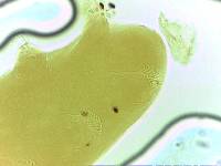Echiniscoides sigismundi image