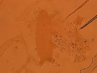 Echiniscoides sigismundi image