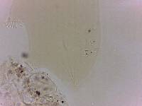 Echiniscoides sigismundi image