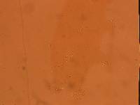 Echiniscoides sigismundi image
