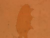 Echiniscoides sigismundi image