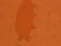 Echiniscoides sigismundi image