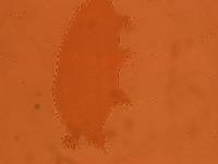 Echiniscoides sigismundi image