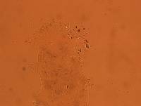 Echiniscoides sigismundi image