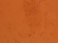 Echiniscoides sigismundi image