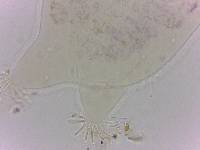 Echiniscoides sigismundi image