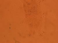 Echiniscoides sigismundi image