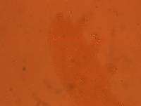 Echiniscoides sigismundi image