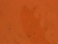 Echiniscoides sigismundi image