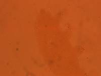 Echiniscoides sigismundi image