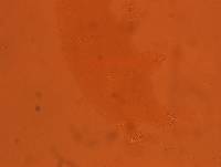 Echiniscoides sigismundi image