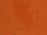 Echiniscoides sigismundi image