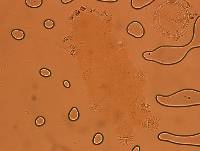 Echiniscoides sigismundi image
