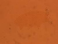 Echiniscoides sigismundi image