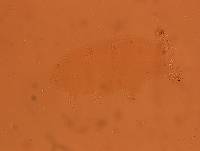 Echiniscoides sigismundi image