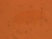 Echiniscoides sigismundi image