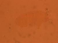Echiniscoides sigismundi image