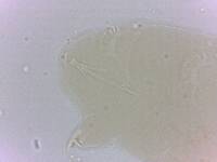 Echiniscoides sigismundi image