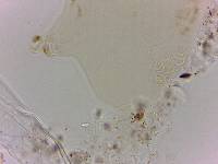 Echiniscoides sigismundi image
