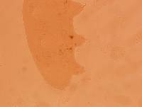 Echiniscoides sigismundi image