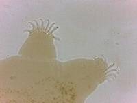 Echiniscoides sigismundi image