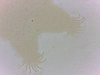 Echiniscoides sigismundi image