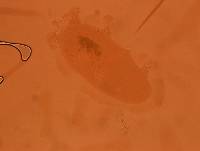 Echiniscoides sigismundi image