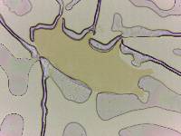 Echiniscoides sigismundi image