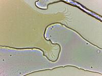 Echiniscoides sigismundi image
