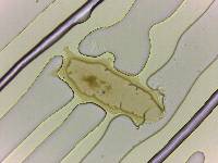 Echiniscoides sigismundi image