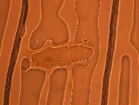 Echiniscoides sigismundi image